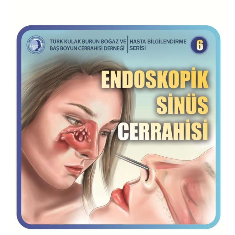 4. endoskopik sinüs cerrahisi (Endsocopic sinus surgery)_page-0001